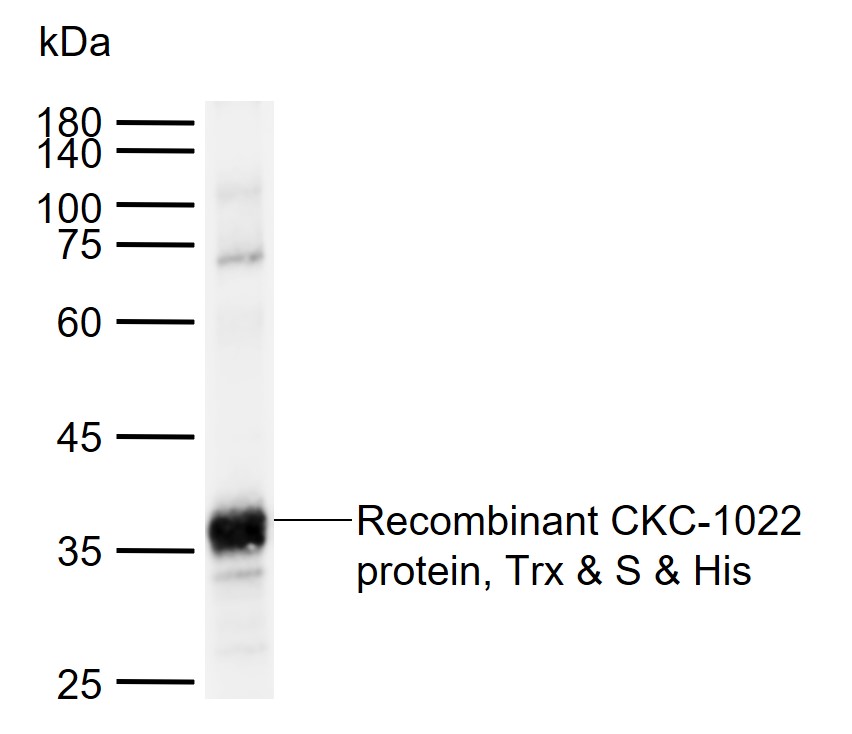 Lso Rabbit pAb(bs-49106R)-50ul