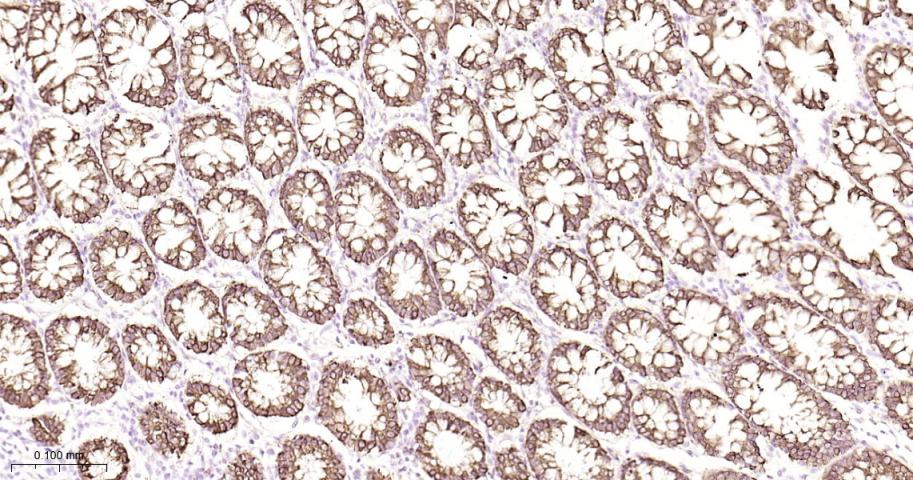 AGR2 Recombinant Rabbit mAb(bs