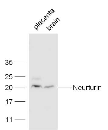 Neurturin Rabbit pAb(bs-0073R)
