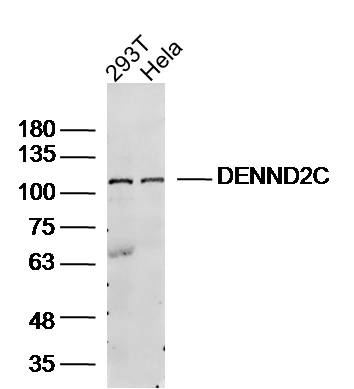 DENND2C Rabbit pAb(bs-9667R)-5