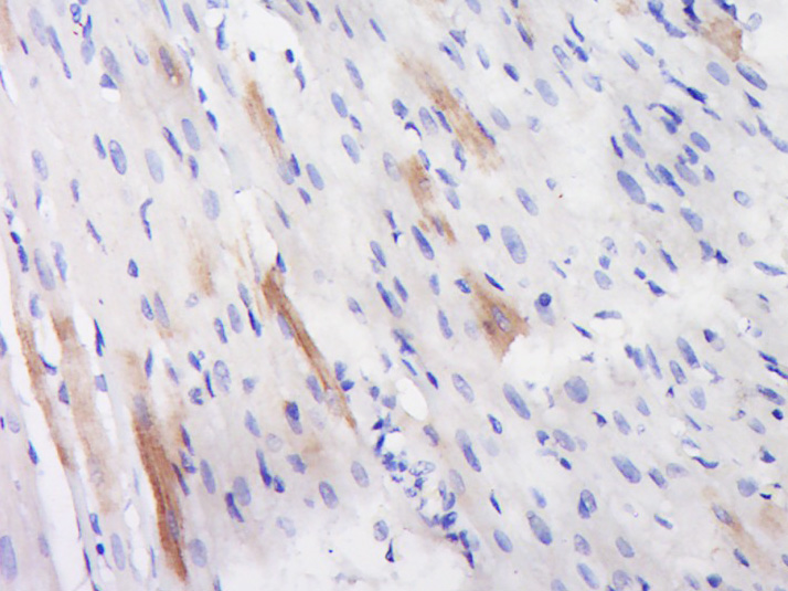 phospho-Smad1 (Ser463) Rabbit 