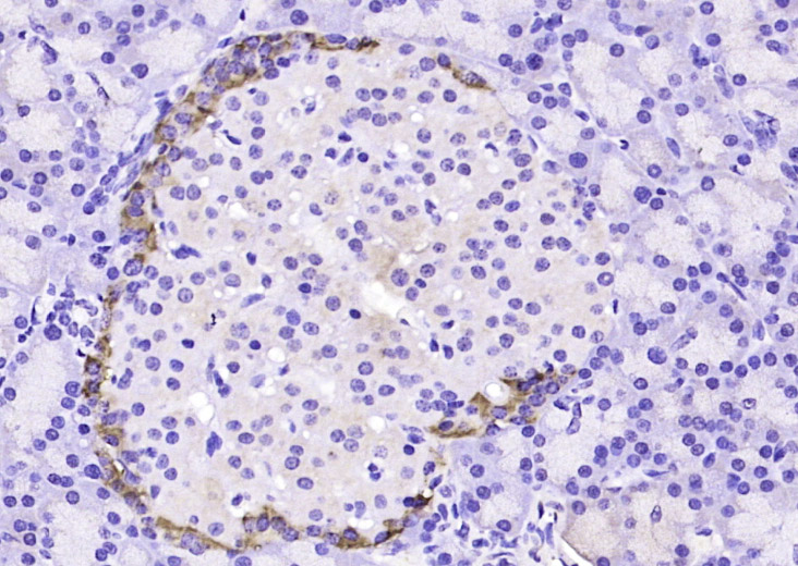 Tuberin Rabbit pAb(bs-3586R)-5