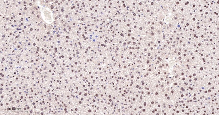 KDM4B Recombinant Rabbit mAb(b