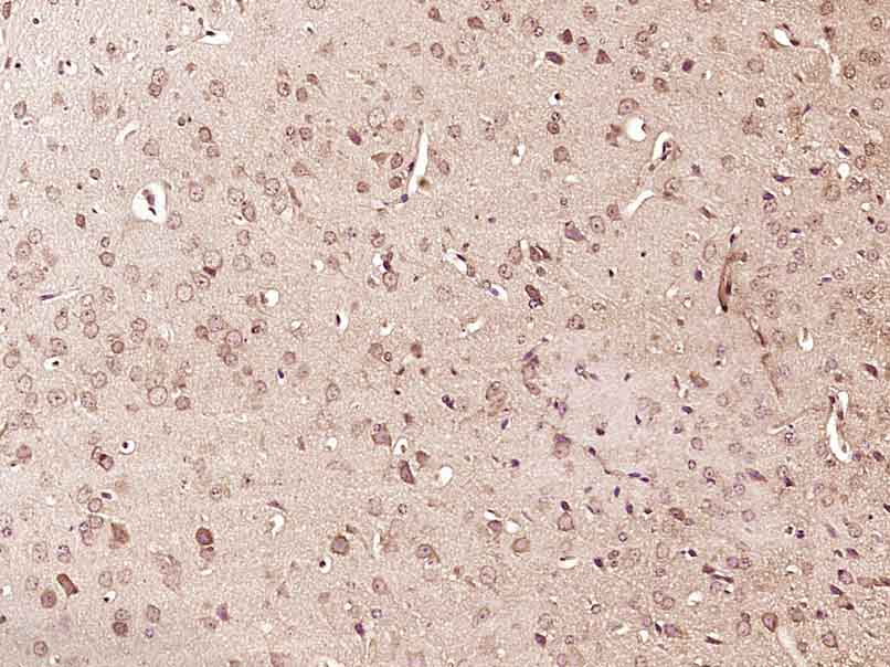 phospho-RPS6KA1 (Thr348) Rabbi