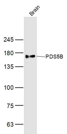PDS5B Rabbit pAb(bs-12605R)-50