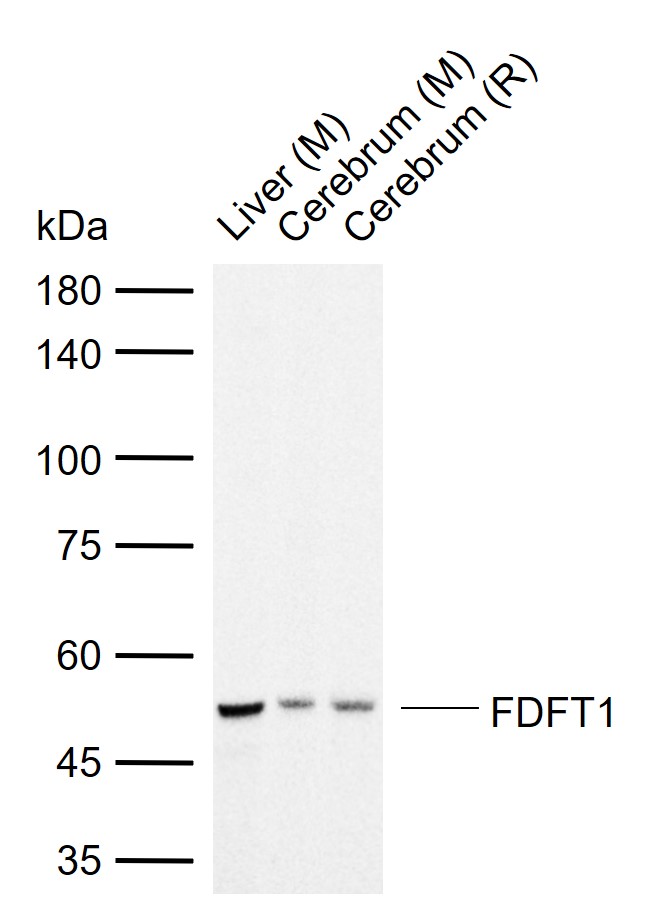 FDFT1 Rabbit pAb(bs-11517R)-50