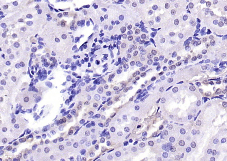 TORC2 Rabbit pAb(bs-3590R)-50u