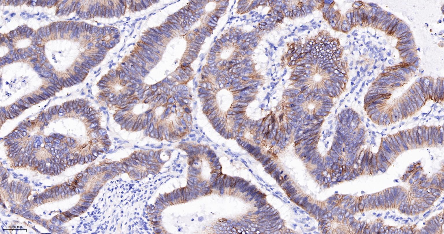 N-cadherin Mouse mAb(bsm-34125