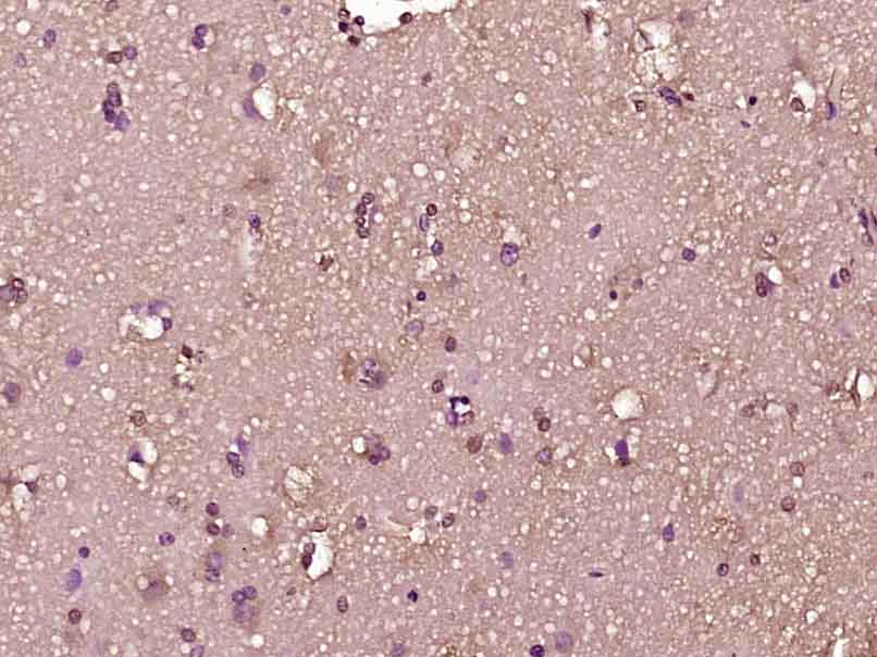 phospho-RPS6KA1 (Thr348) Rabbi