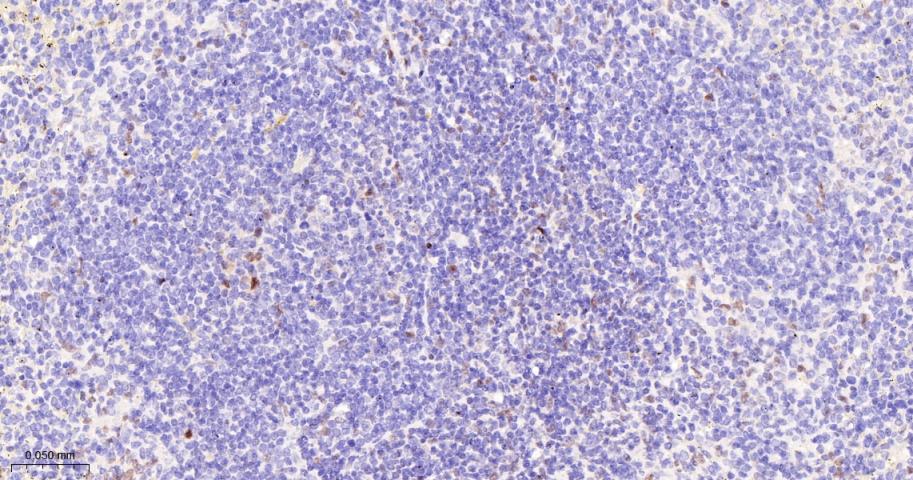 JUNB Recombinant Rabbit mAb(bs