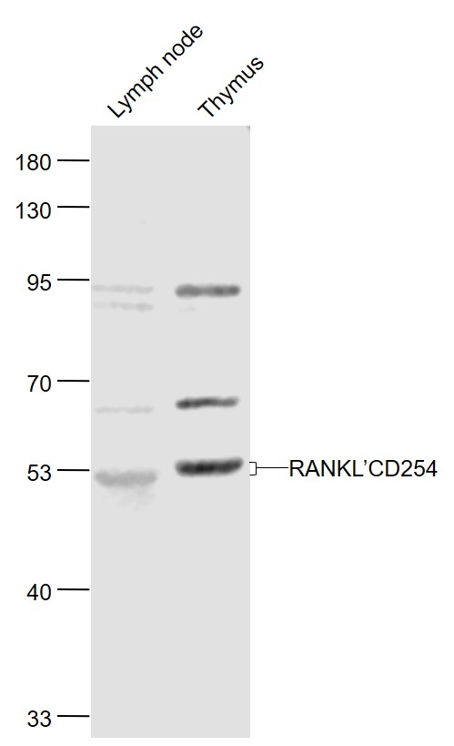 RANKL/CD254 Rabbit pAb(bs-0747