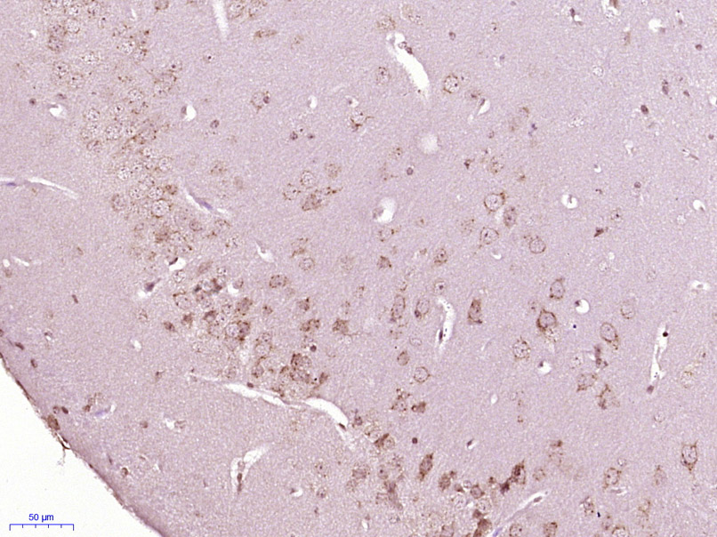 RASL10A Rabbit pAb(bs-5722R)-5