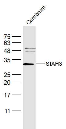 SIAH3 Rabbit pAb(bs-17481R)-50