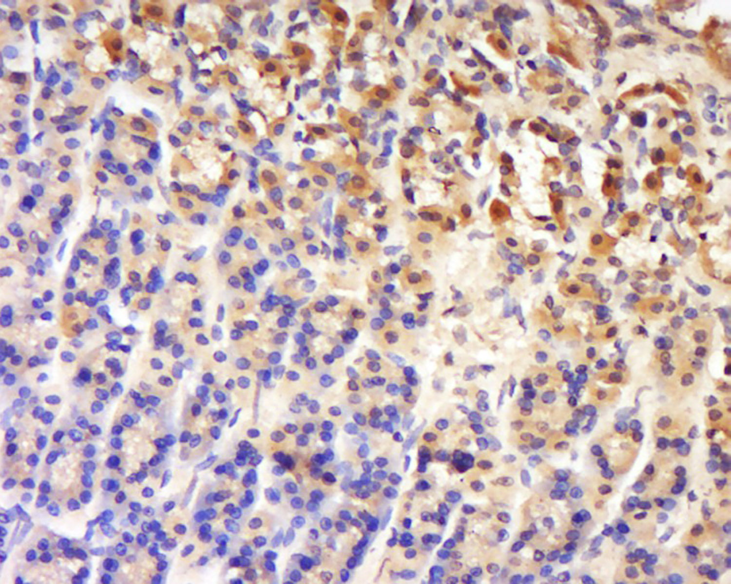 LRCH4/LRRN1 Rabbit pAb(bs-9330