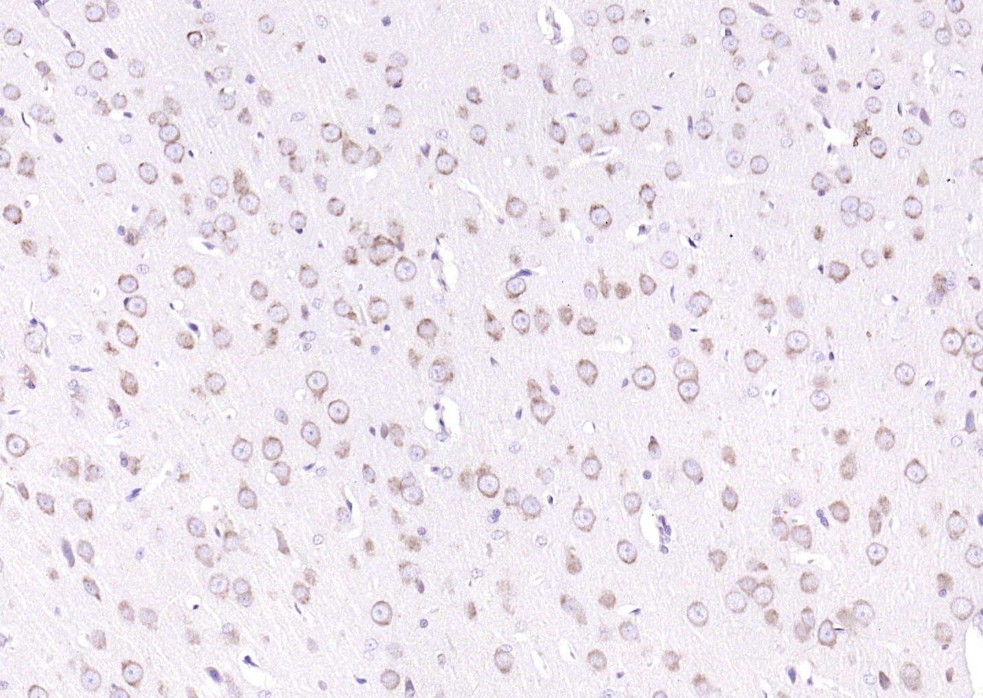 GRP94 Rabbit pAb(bs-0194R)-50u