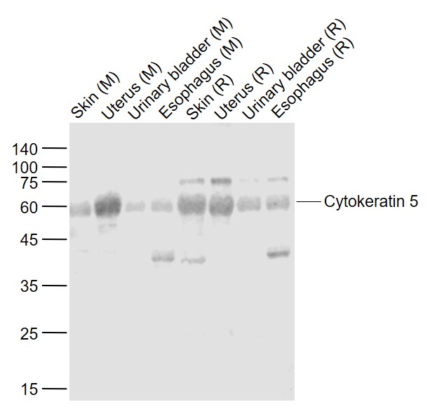 pan-cytokeratin Rabbit pAb(bs-
