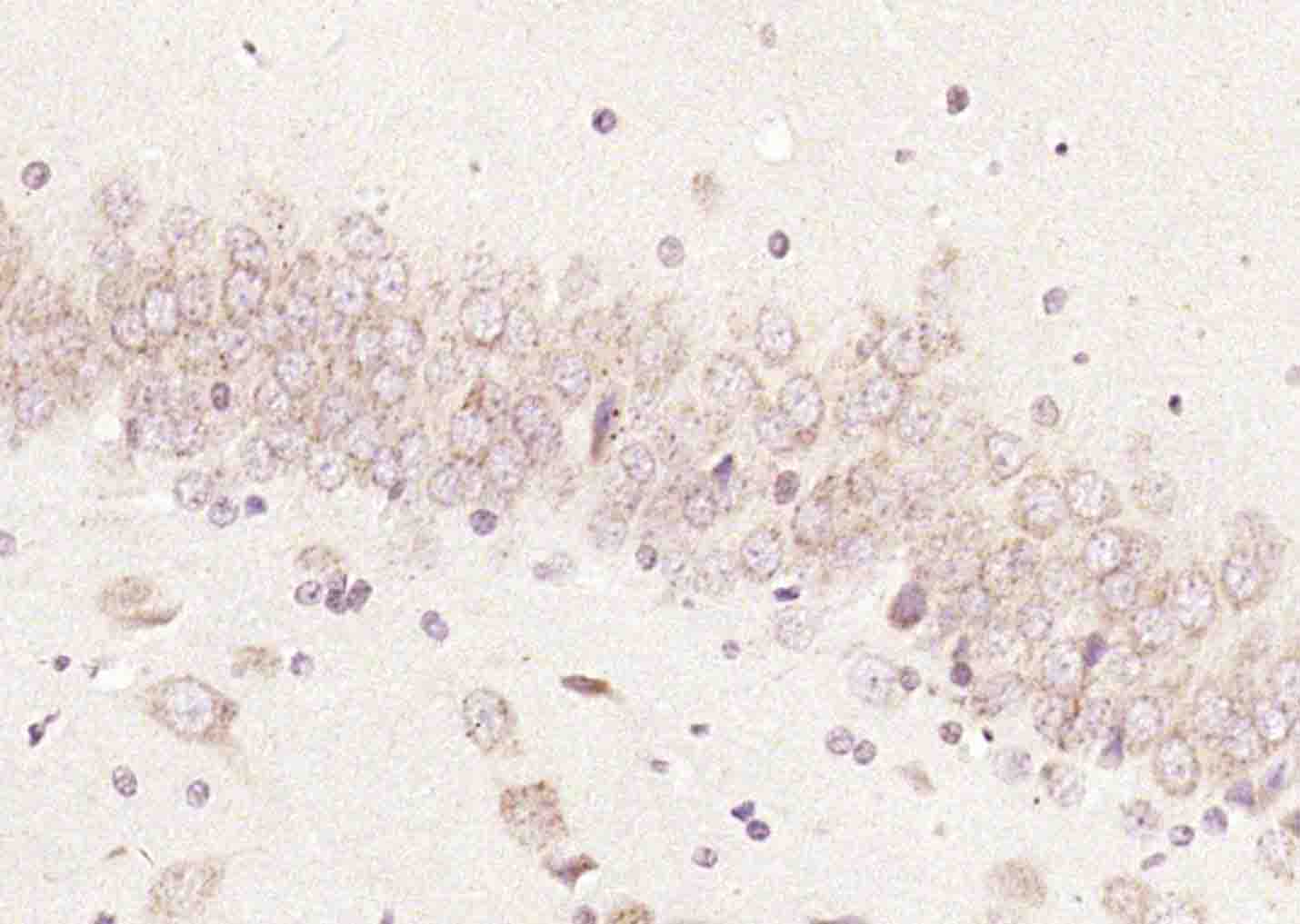 CDK4 Rabbit pAb(bs-0633R)-50ul