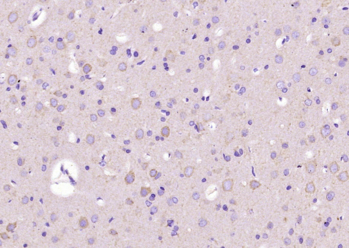 phospho-LIMK1 (Thr508) + LIMK2