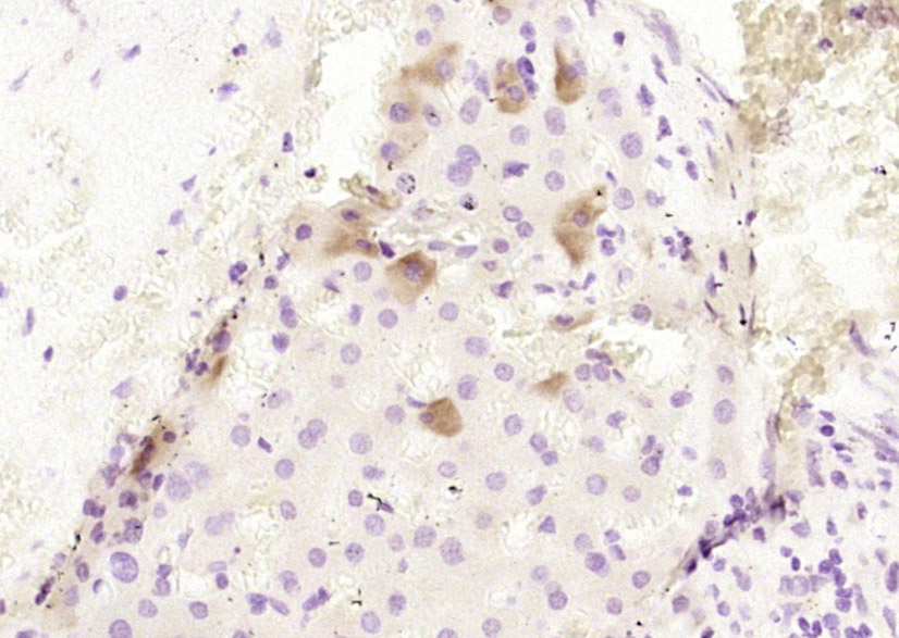 CPB2 Rabbit pAb(bs-7547R)-50ul