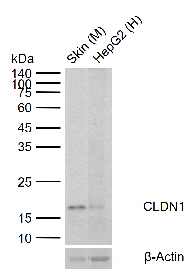 CLDN1 Recombinant Rabbit mAb(b