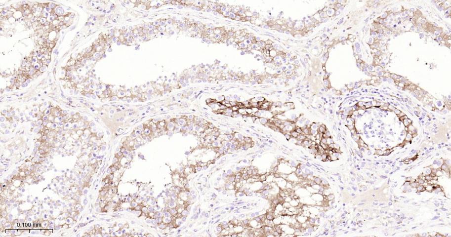 ITGB3 Recombinant Rabbit mAb(b