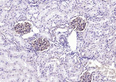 ITGAV Rabbit pAb(bs-2203R)-50u