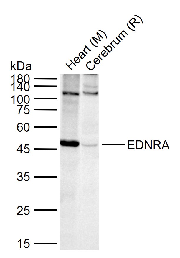 EDNRA Rabbit pAb(bs-1757R)-50u