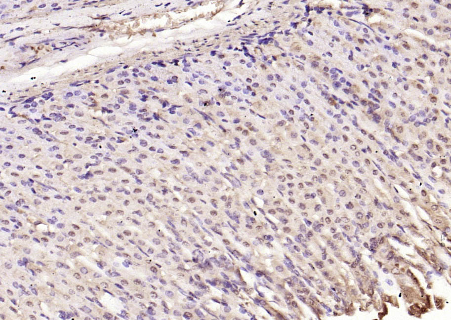 SQSTM1/P62 Rabbit pAb(bs-2951R