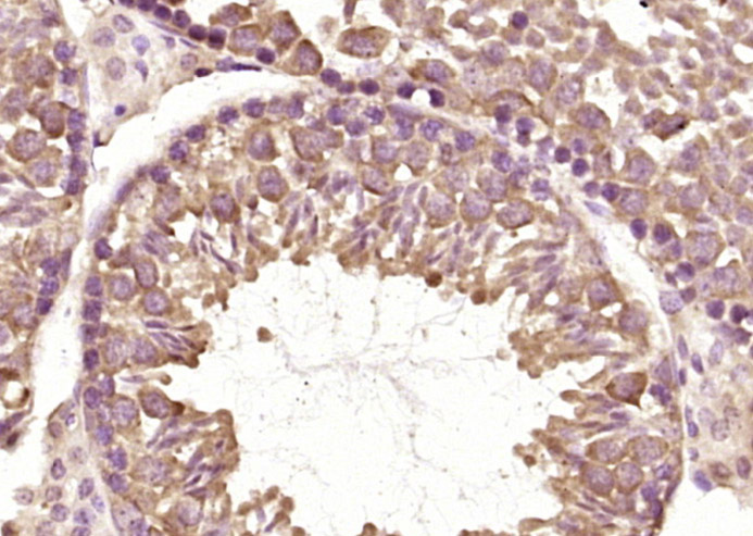 FBXO31 Rabbit pAb(bs-6006R)-50