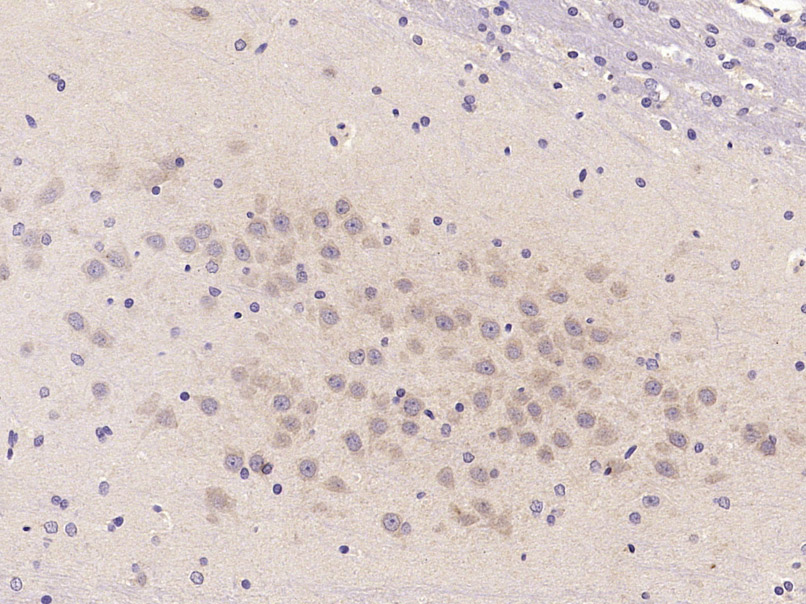 beta IV Tubulin Rabbit pAb(bs-