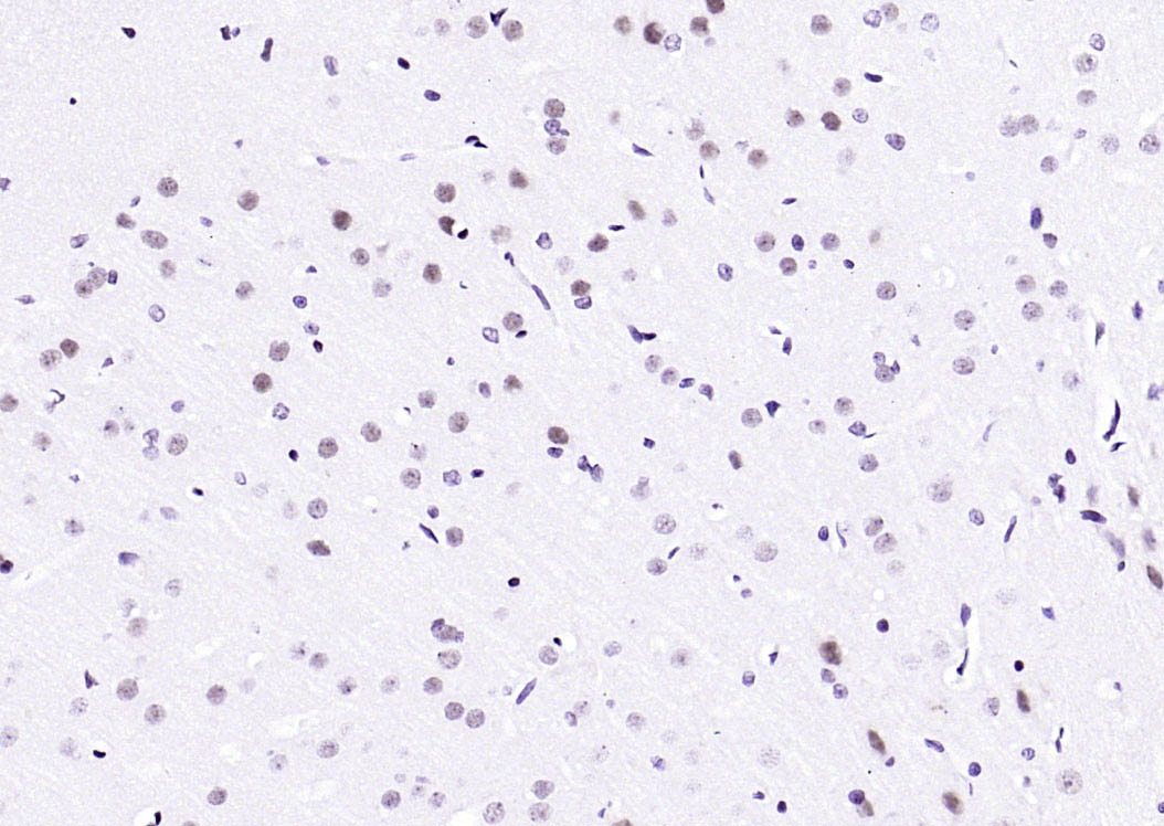 API5 Rabbit pAb(bs-1252R)-50ul