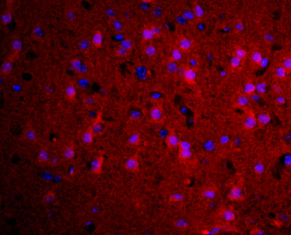 Transglutaminase 2 Rabbit pAb(