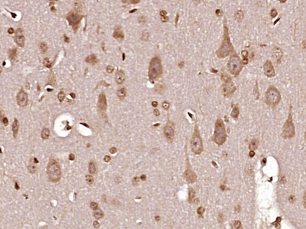 MT-ND6 Rabbit pAb(bs-3955R)-50