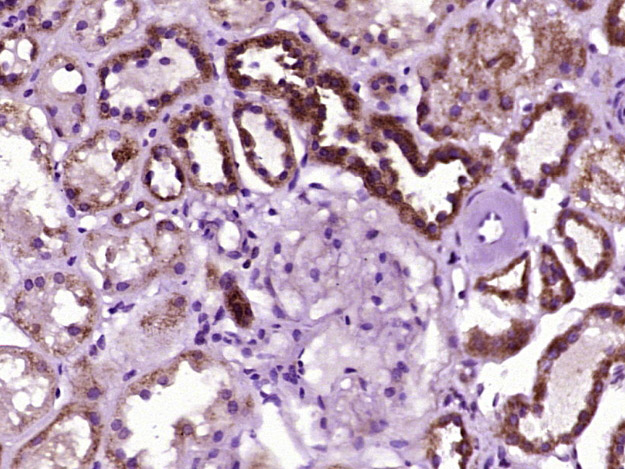 ACACA Rabbit pAb(bs-2745R)-50u