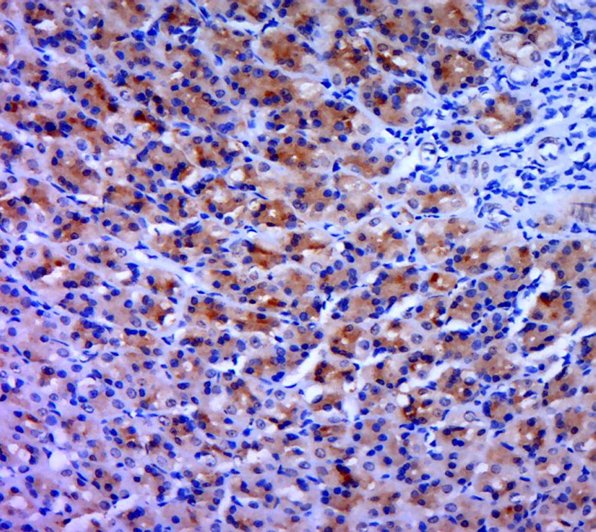 ROCK1 + ROCK2 Rabbit pAb(bs-10