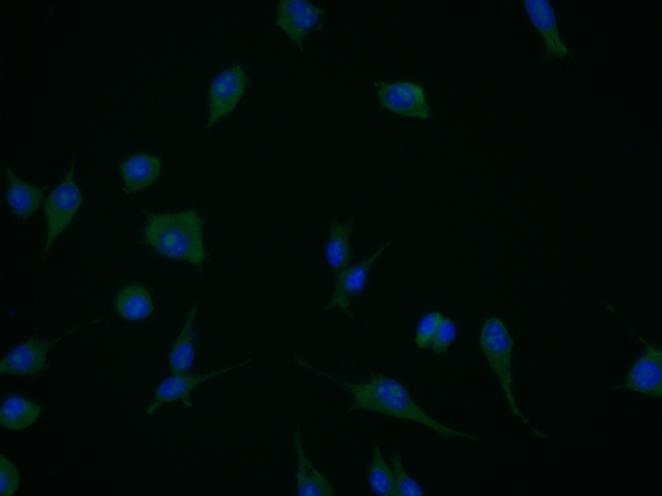 HECT E3 ubiquitin ligase Rabbi