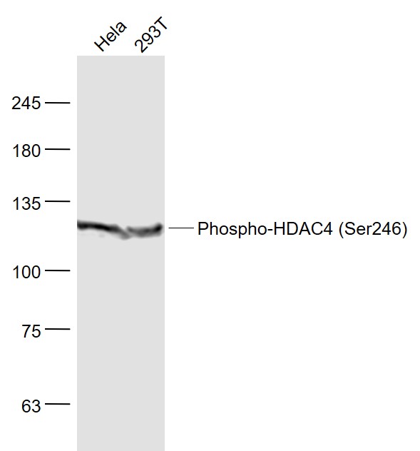 phospho-HDAC4 (Ser246) Rabbit 
