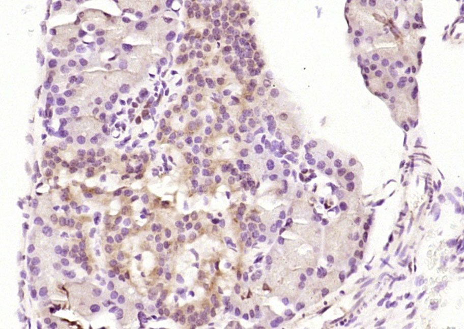 Karyopherin beta 3 Rabbit pAb(