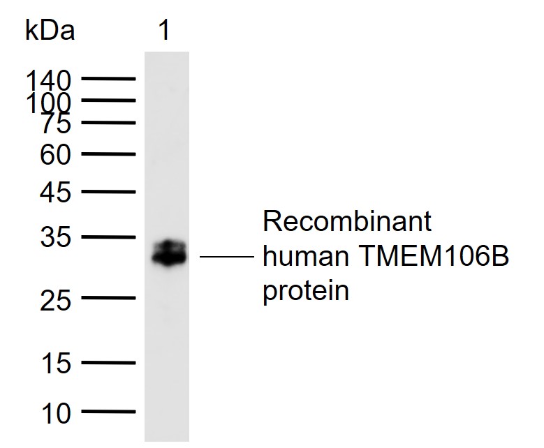 TMEM106B Rabbit pAb(bs-25543R)