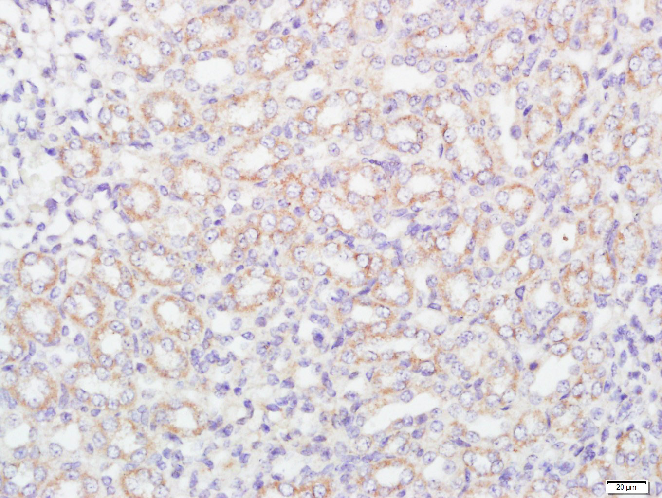 FCAR/CD89 Rabbit pAb(bs-6586R)