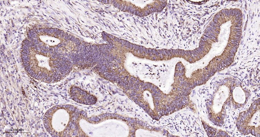 SDHB Recombinant Rabbit mAb(bs