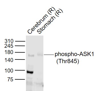 phospho-ASK1 (Thr845) Rabbit p