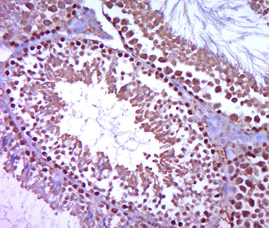 Plzf Rabbit pAb(bs-5971R)-50ul