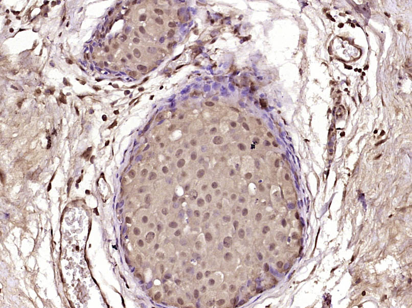 CECR2 Rabbit pAb(bs-13824R)-50