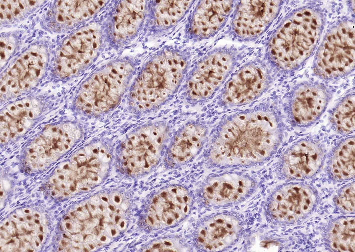 MUC2 Rabbit pAb(bs-60331R)-50u