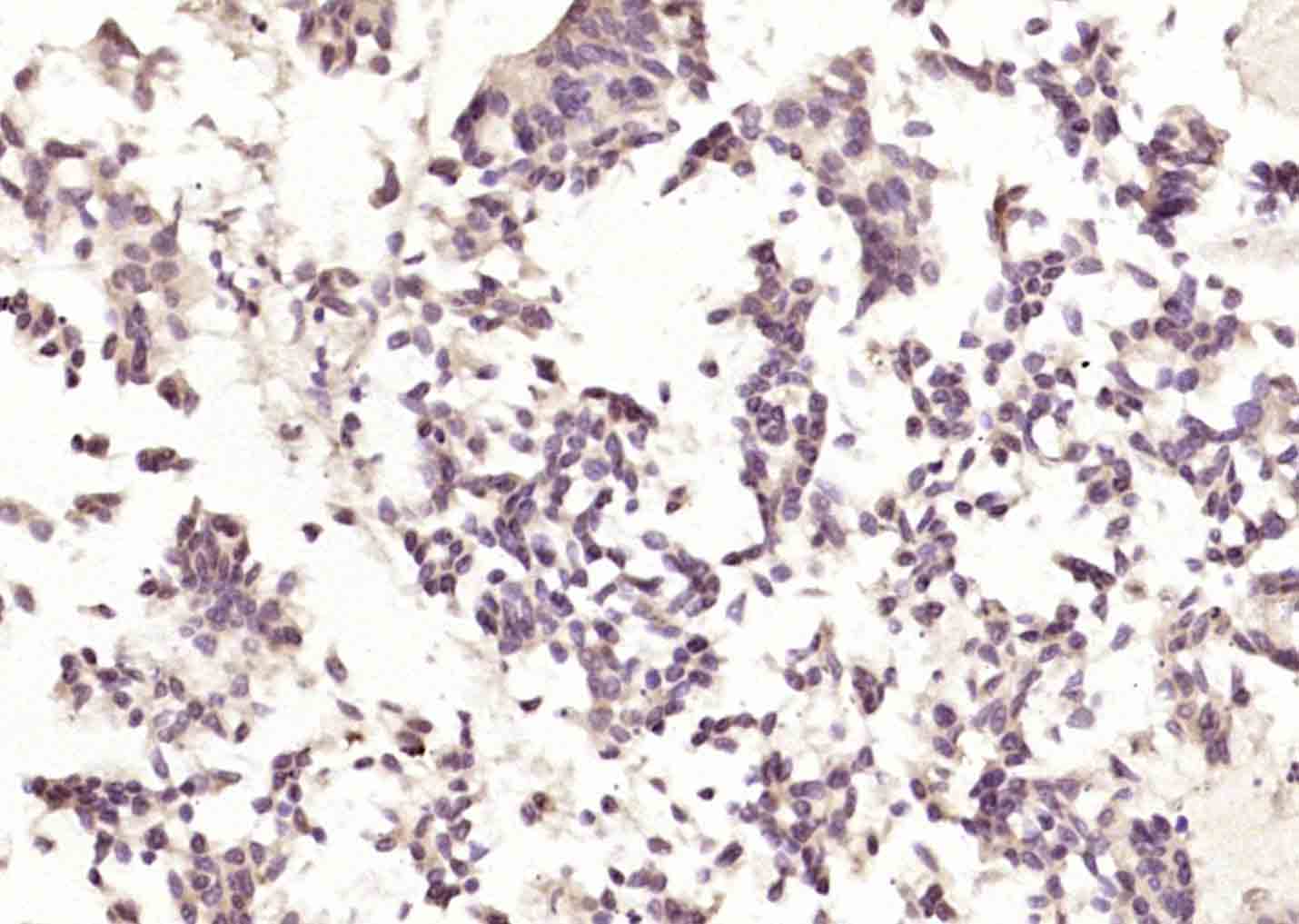 phospho-Bcl-2 (Ser70) Rabbit p