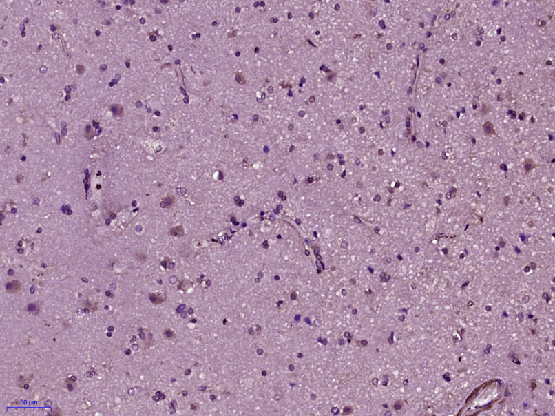 PKA C alpha + beta Rabbit pAb(