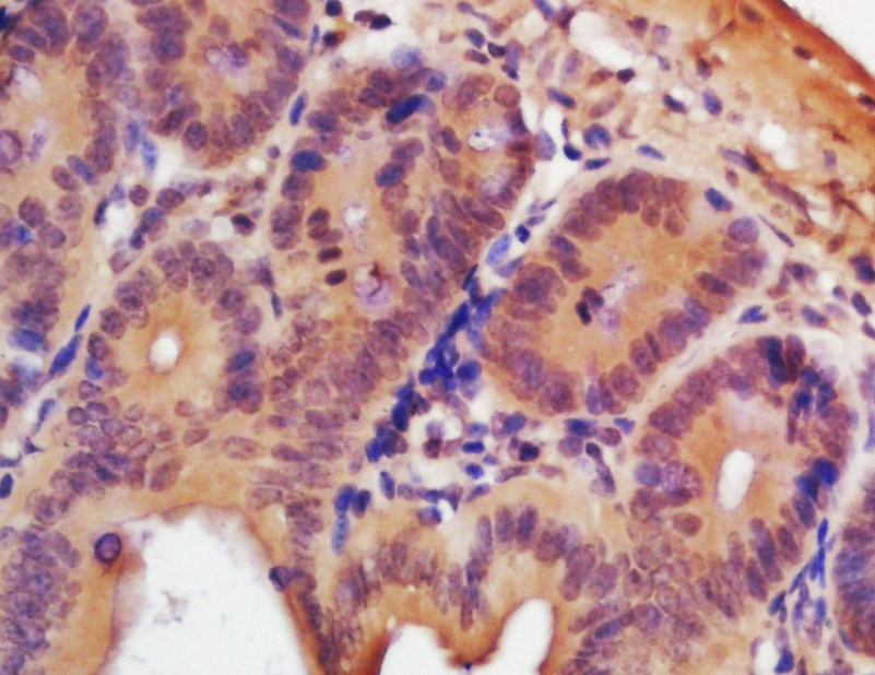 TSPYL5 Rabbit pAb(bs-7703R)-50