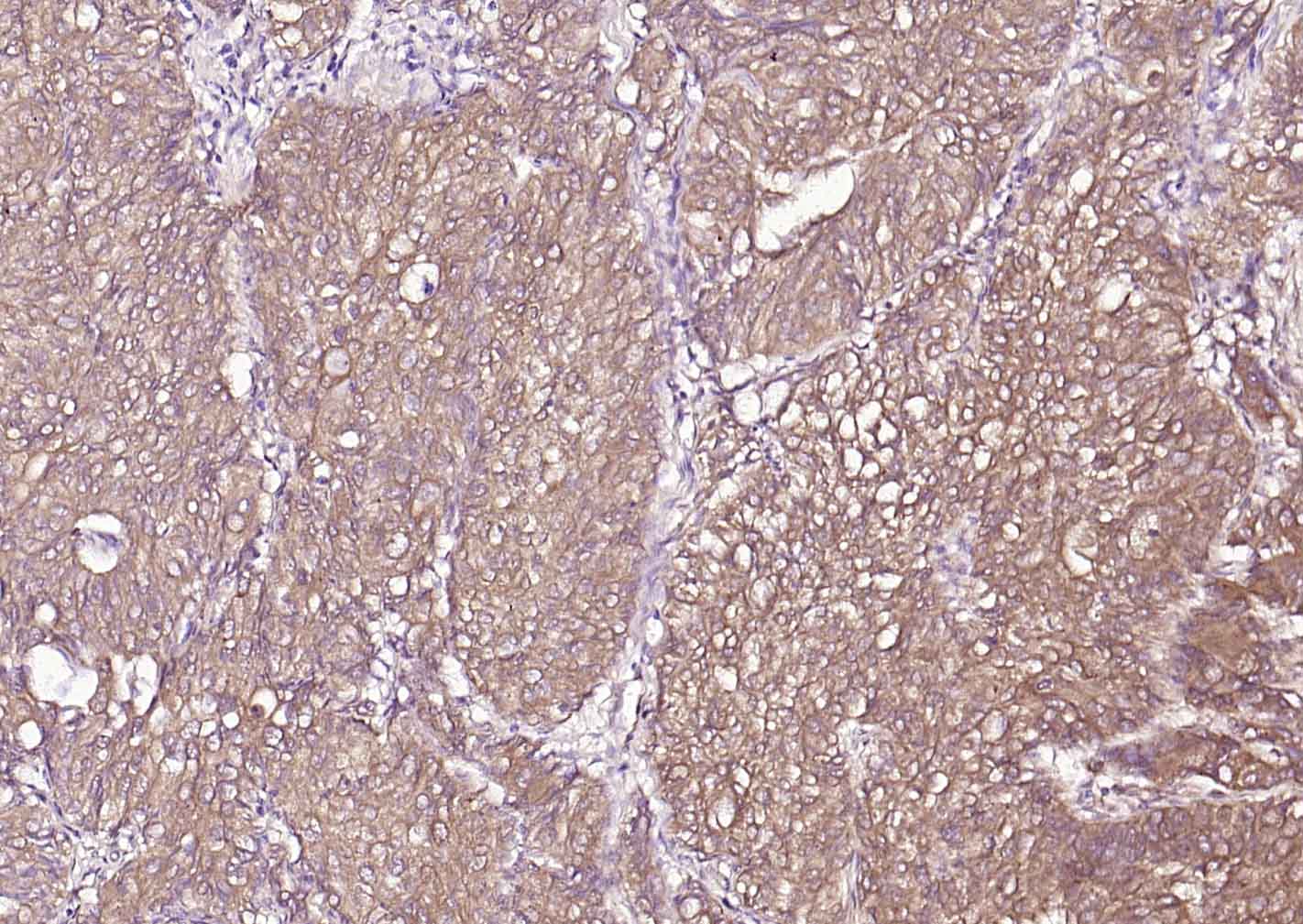 P4HB Recombinant Mouse mAb(bsm