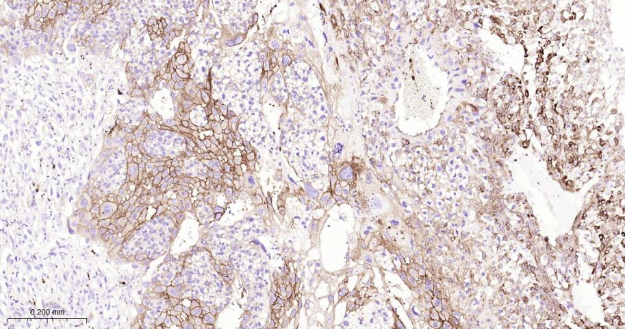 ITGB3 Recombinant Rabbit mAb(b